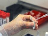 Ue, in arrivo cinque nuove terapie per la cura del Covid