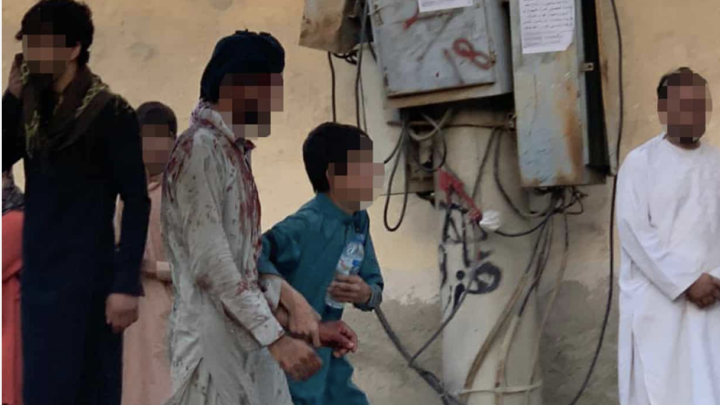 Afghanistan, esplosioni a Kabul. Almeno 13 morti e 143 feriti