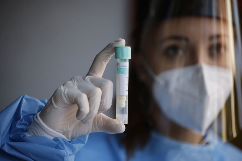 Covid, 4.021 nuovi casi 72 decessi e tasso positività a 1,26% Covid, 4.021 nuovi casi 72 decessi e tasso positività a 1,26%