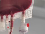 Carenza di 650 unità di sangue in Italia