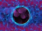 Un nanosistema per contrastare il tumore al colon