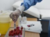 Covid, 6.764 nuovi casi e 31 decessi nelle ultime 24 ore