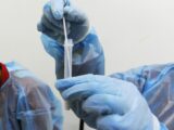 Covid, 93.157 nuovi casi e 375 decessi nelle ultime 24 ore