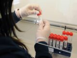 Covid, il 31 gennaio la variante Omicron nel 99,1% dei campioni