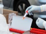 Covid, 24.408 nuovi casi e 201 decessi in 24 ore