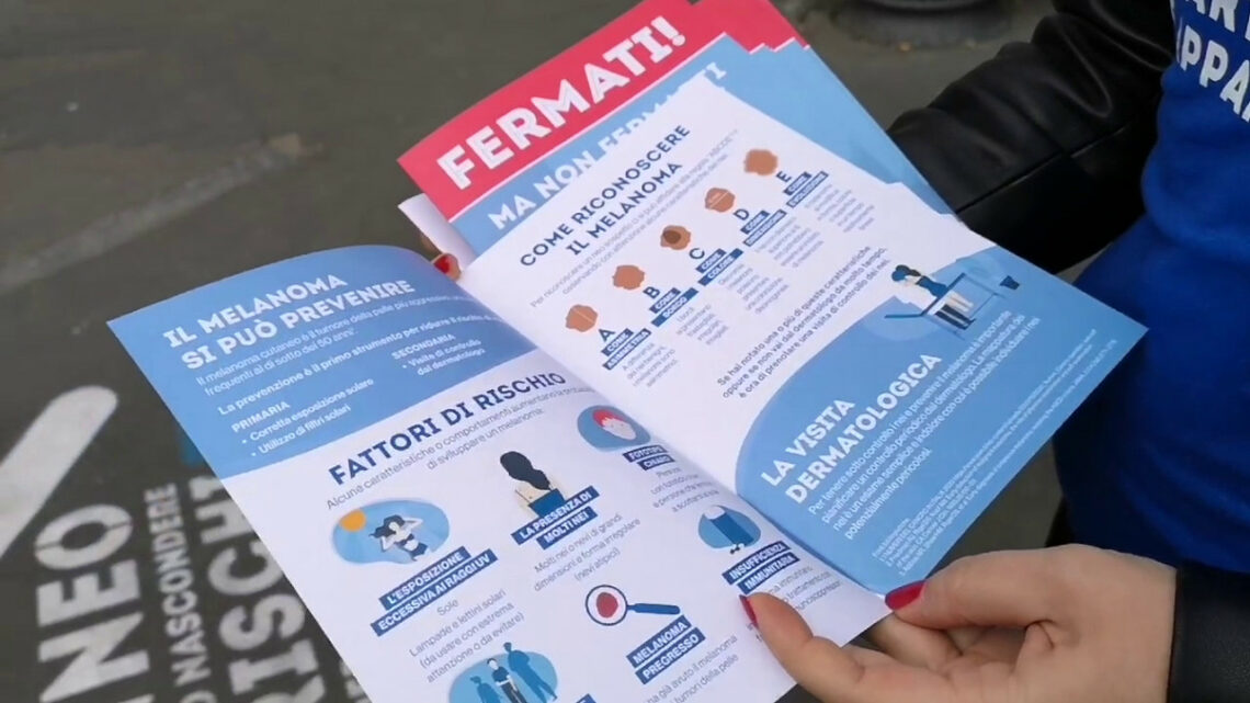 “La prevenzione al centro” contro il melanoma “La prevenzione al centro” contro il melanoma