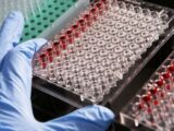 Ricerca in Onco-Ematologia, premiati i vincitori del bando di Sanofi