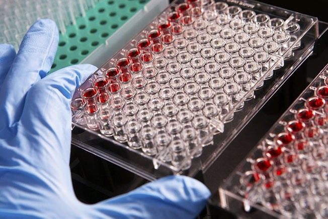 Ricerca in Onco-Ematologia, premiati i vincitori del bando di Sanofi Ricerca in Onco-Ematologia, premiati i vincitori del bando di Sanofi