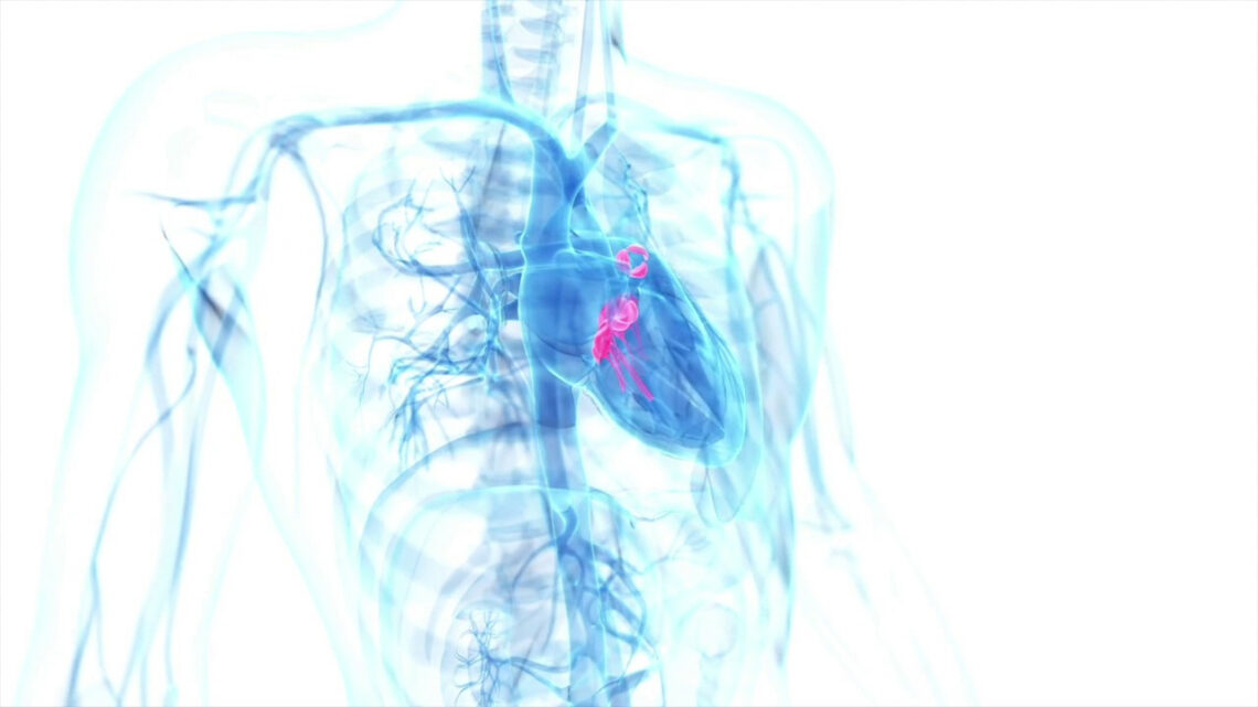 Ampliare rete delle emodinamiche per curare le valvulopatie cardiache Ampliare rete delle emodinamiche per curare le valvulopatie cardiache