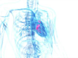 Ampliare rete delle emodinamiche per curare le valvulopatie cardiache