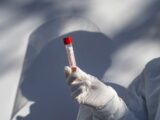 Covid, in aumento incidenza, Rt e anche occupazione intensive