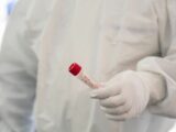 Covid, in Italia 84.700 casi e 63 decessi nelle ultime 24 ore