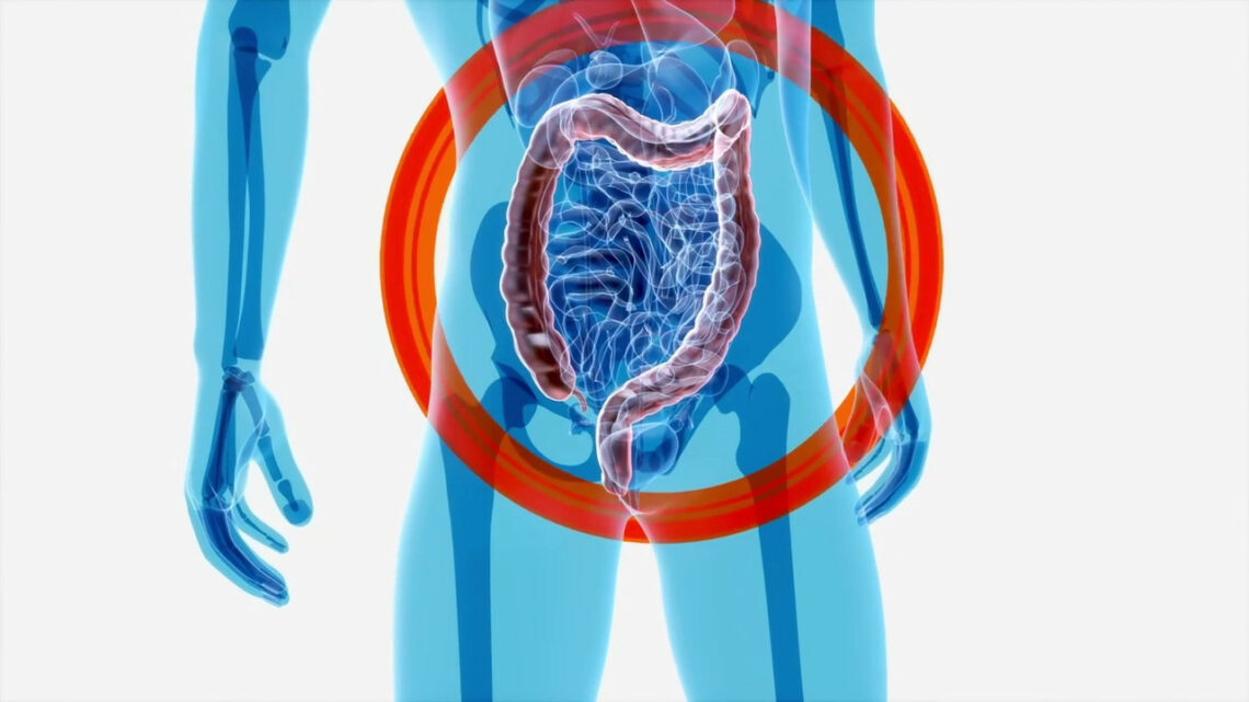 Intestino, l’importanza della varietà dei microrganismi Intestino, l’importanza della varietà dei microrganismi