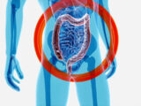 Intestino, l’importanza della varietà dei microrganismi
