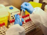 Il bollettino dei dati Covid diventa settimanale