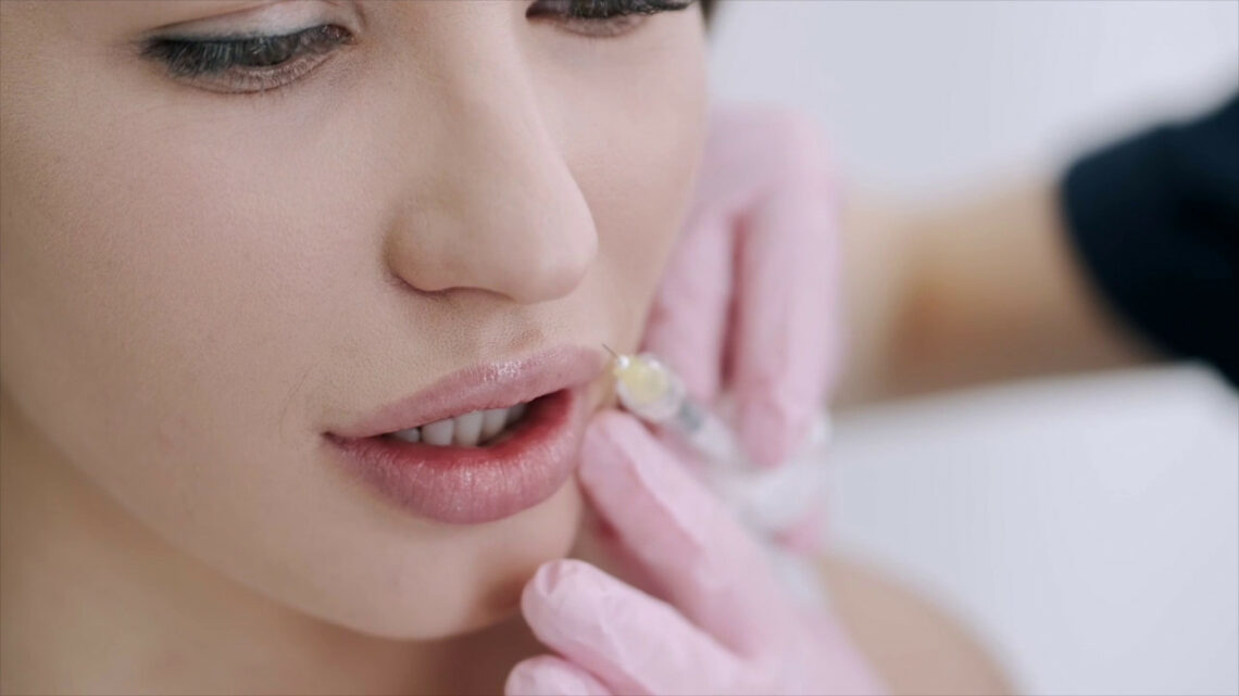 Chirurgia estetica, filler e botox: ecco pro e contro Chirurgia estetica, filler e botox: ecco pro e contro