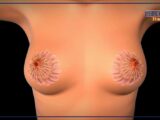 Tumore al seno, la sopravvivenza a 5 anni dalla diagnosi è dell’88%