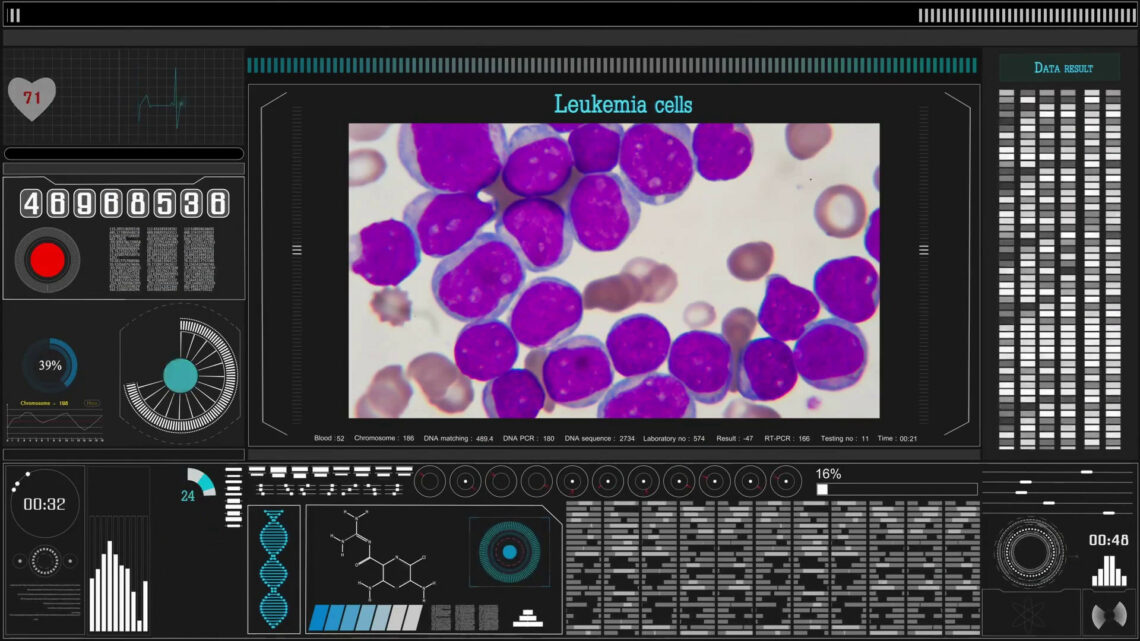 Un nuovo strumento per predire il rischio di leucemia Un nuovo strumento per predire il rischio di leucemia