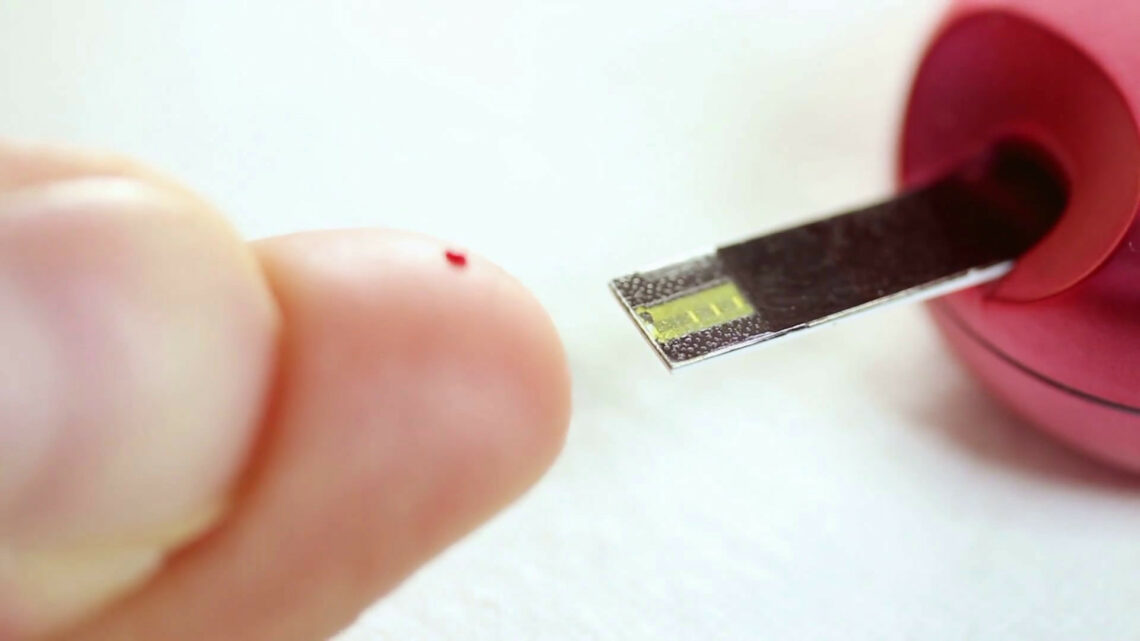 Diabete di tipo 1 autoimmune, nuovi studi su un farmaco Diabete di tipo 1 autoimmune, nuovi studi su un farmaco