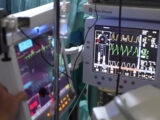 Trapianti, per il futuro prospettive incoraggianti