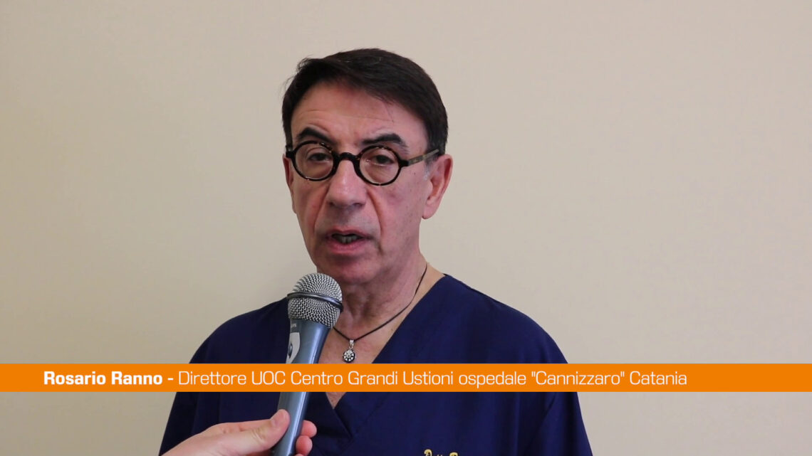 Vampata per grigliata di Pasquetta, tre giovani ustionati nel Catanese Vampata per grigliata di Pasquetta, tre giovani ustionati nel Catanese