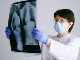Colonscopia, un esame sempre più curativo