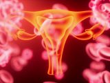 Un vaccino contro il tumore dell’endometrio