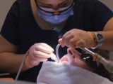 Implantologia dentale, attenzione ai “procuratori d’affari” all’estero