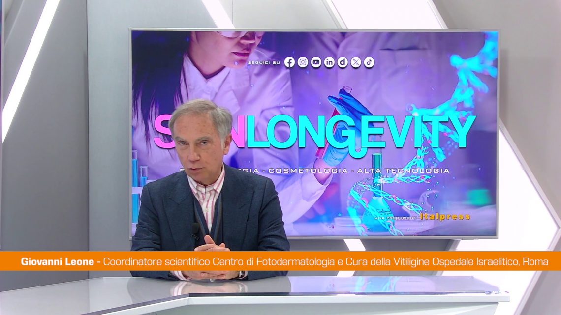 Vitiligine, dai farmaci biologici una svolta nella cura Vitiligine, dai farmaci biologici una svolta nella cura