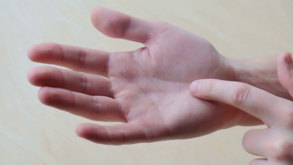 Sindrome del tunnel carpale, ecco chi è più a rischio Sindrome del tunnel carpale, ecco chi è più a rischio