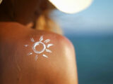 Cinque scottature aumentano il rischio melanoma dell’80%